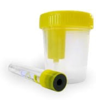 Acofar Kit Envase Recogida Muestras de Orina 120ml + Tubo